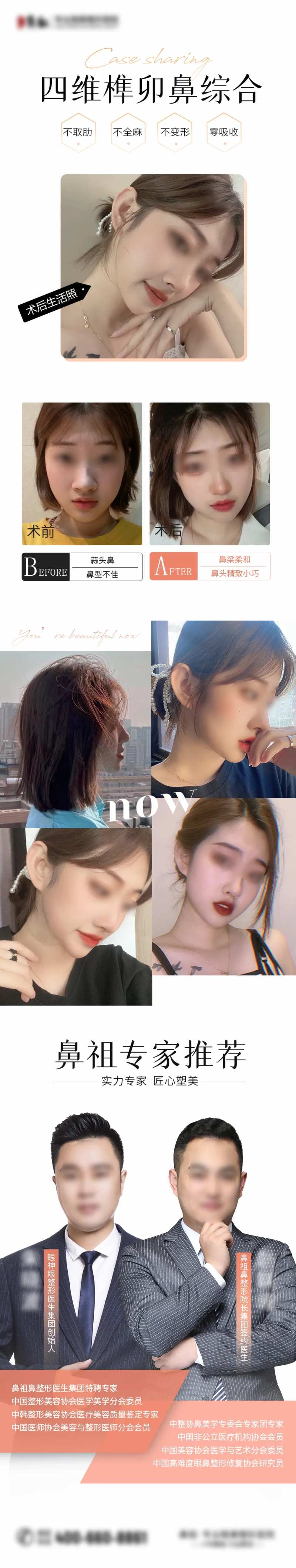 医美隆鼻对比海报-采灵感-cailinggan.com