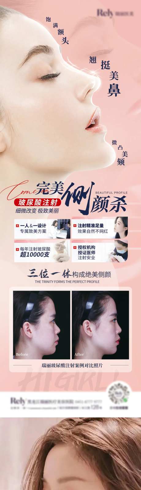 医美暑期翘鼻海报-采灵感-https://www.cailinggan.com/