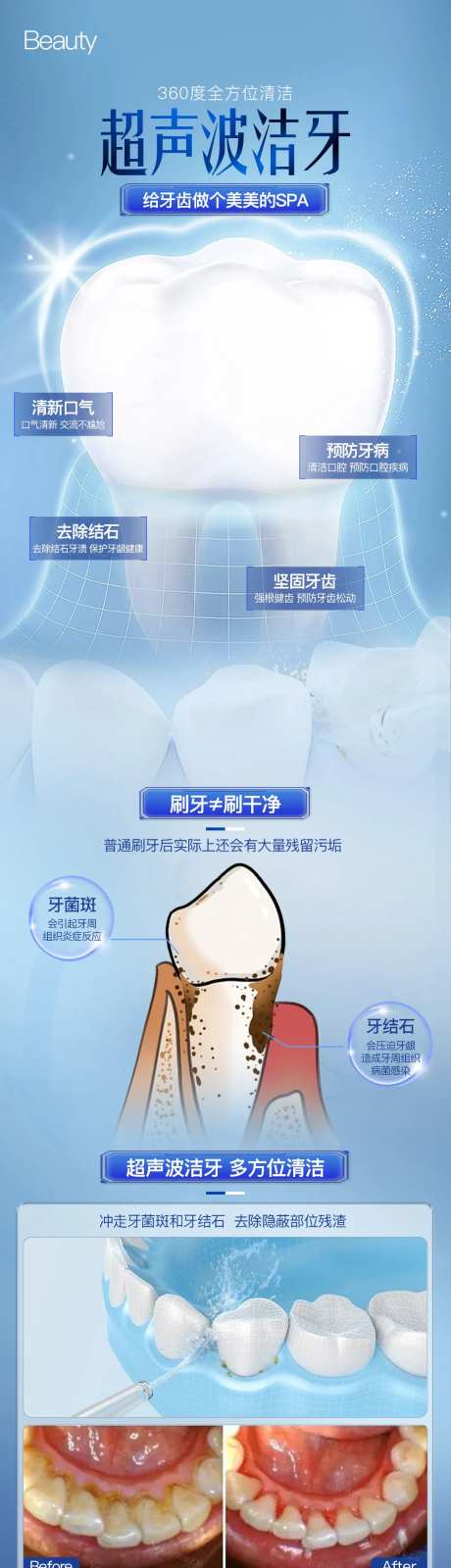 口腔超声波洁牙海报-采灵感-https://www.cailinggan.com/