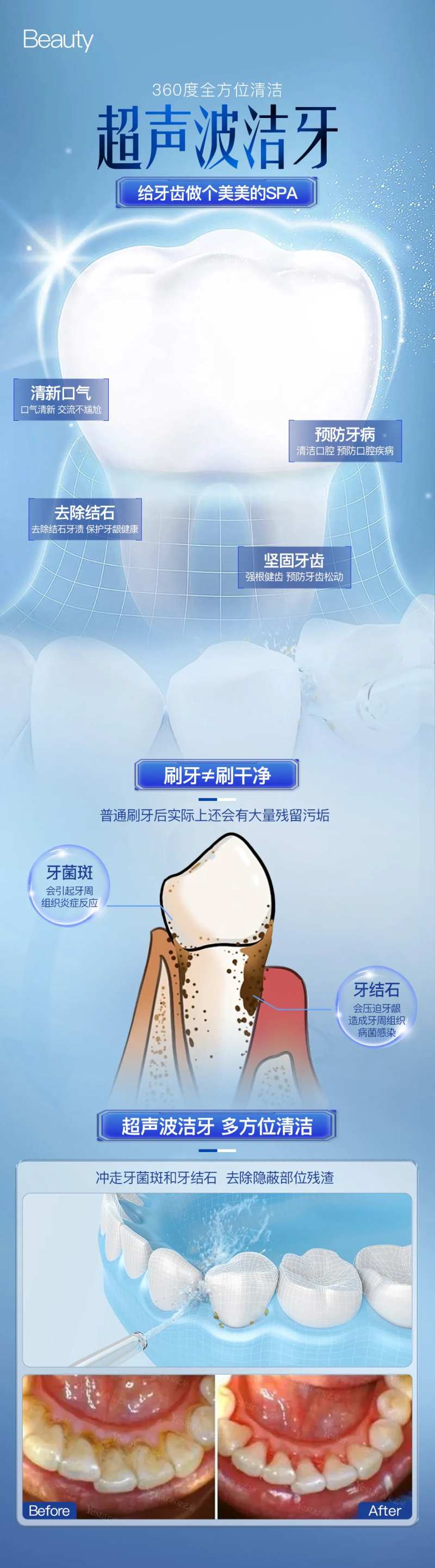 口腔超声波洁牙海报-采灵感-cailinggan.com