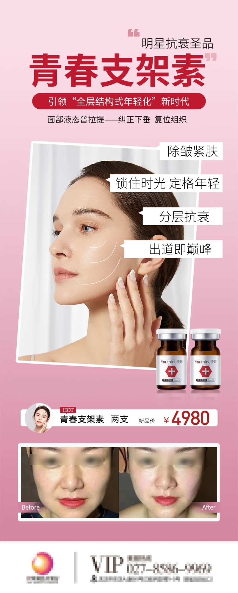 青春支架素医美海报-采灵感-cailinggan.com