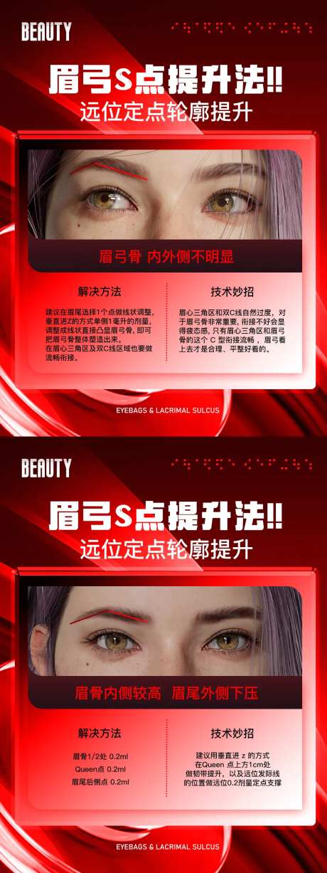 医美科普眉弓S点提升法海报-采灵感-https://www.cailinggan.com/