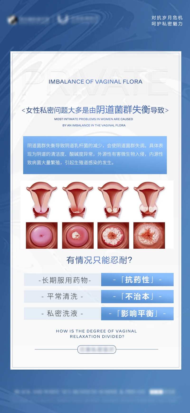 女性私密科普海报-采灵感-cailinggan.com