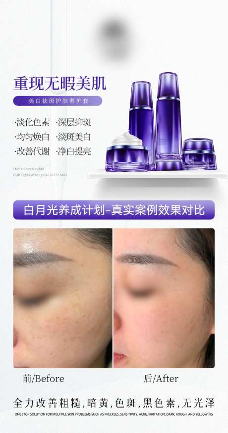 祛斑对比海报-采灵感-https://www.cailinggan.com/