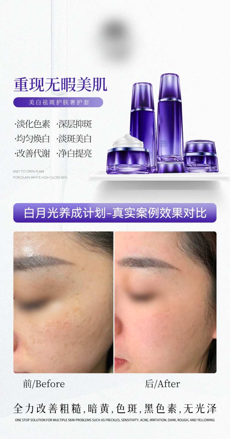 祛斑对比海报-采灵感-cailinggan.com