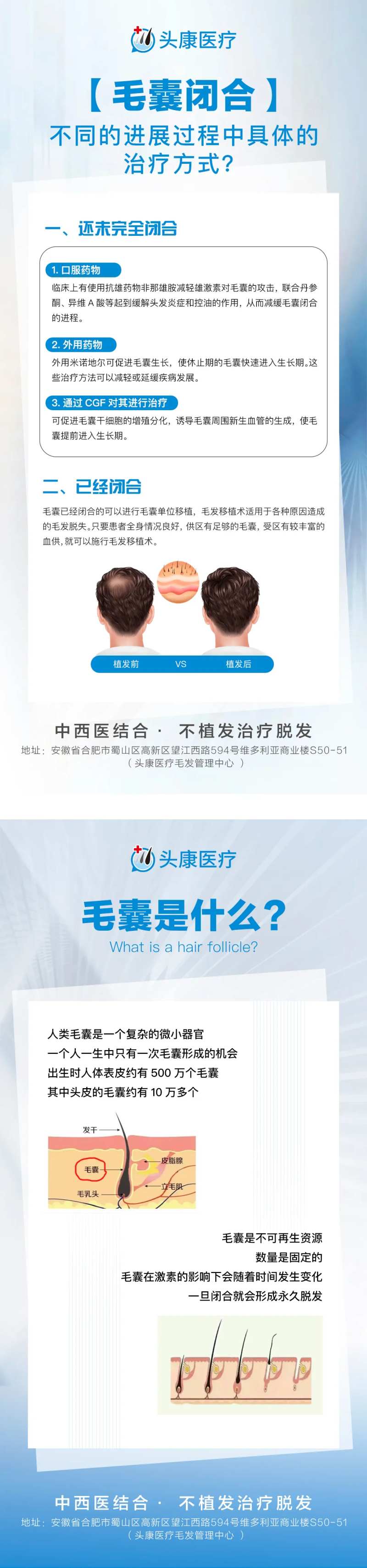 毛囊闭合科普海报-采灵感-cailinggan.com