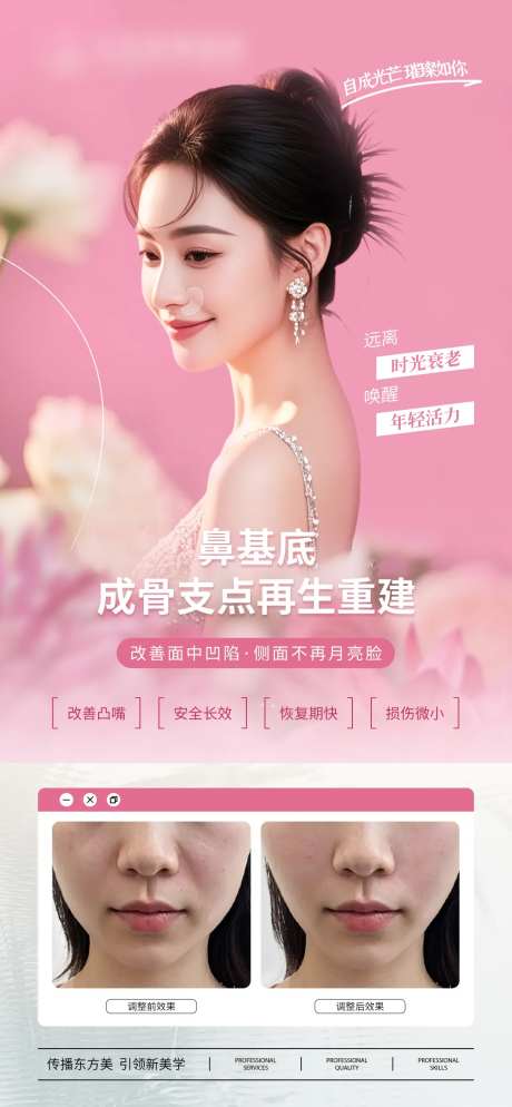 医美鼻基底调整案例对比宣传海报-采灵感-https://www.cailinggan.com/