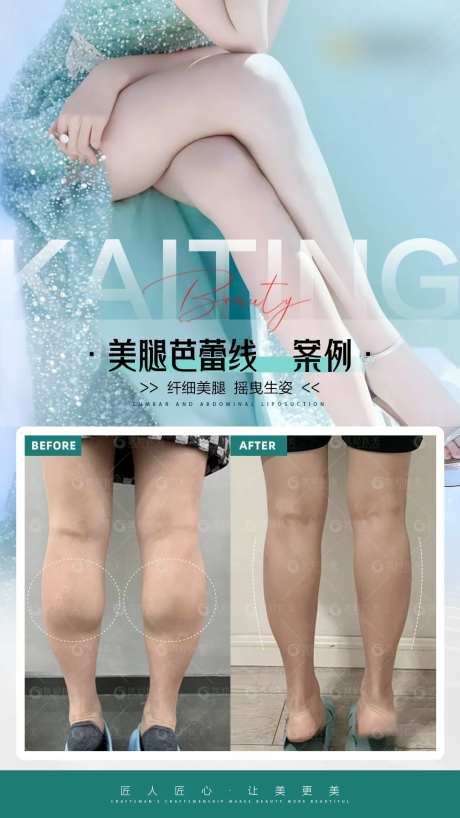 医美对比图案例腿 -采灵感-https://www.cailinggan.com/