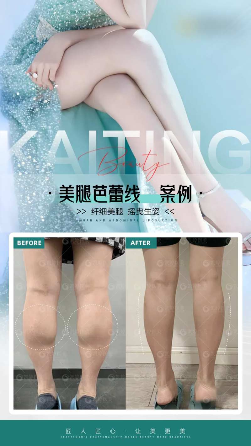医美对比图案例腿 -采灵感-cailinggan.com