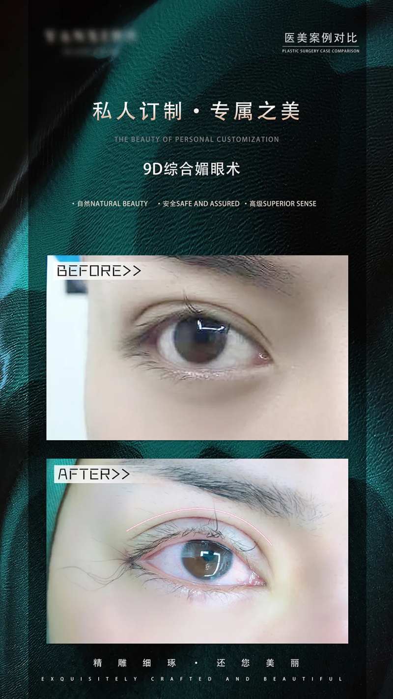 眼综合案例对比绿金海报-采灵感-cailinggan.com