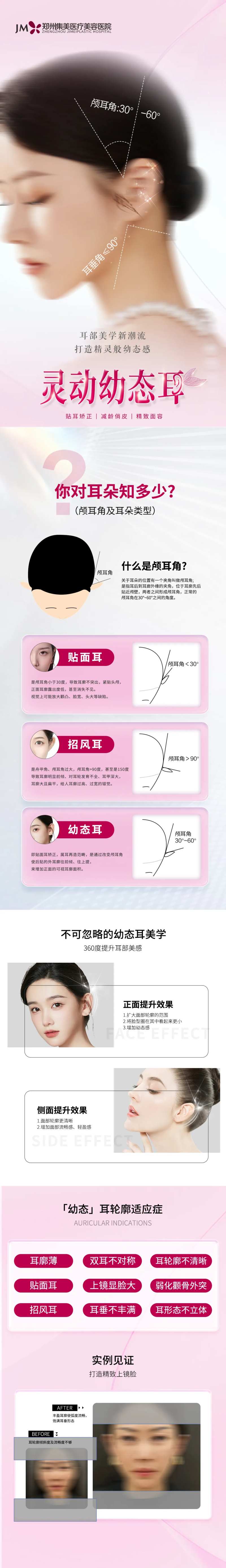 医美精灵耳长图-采灵感-cailinggan.com