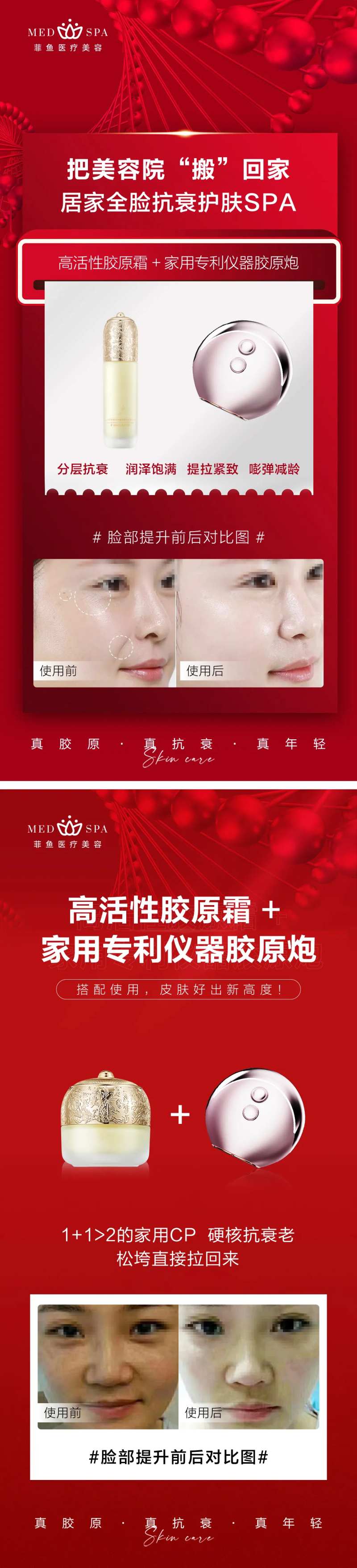 医美胶原抗衰护肤SPA对比图-采灵感-cailinggan.com