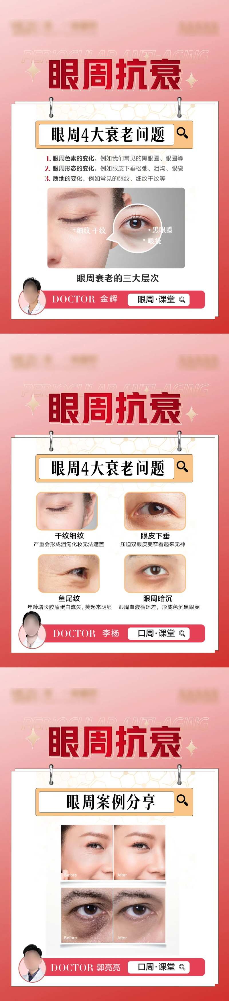 整形眼周抗衰海报-采灵感-cailinggan.com