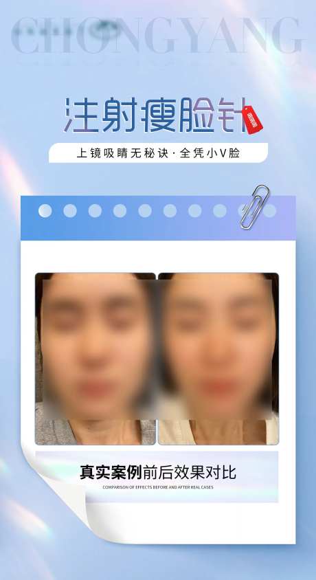 医美瘦脸针案例对比海报-采灵感-https://www.cailinggan.com/