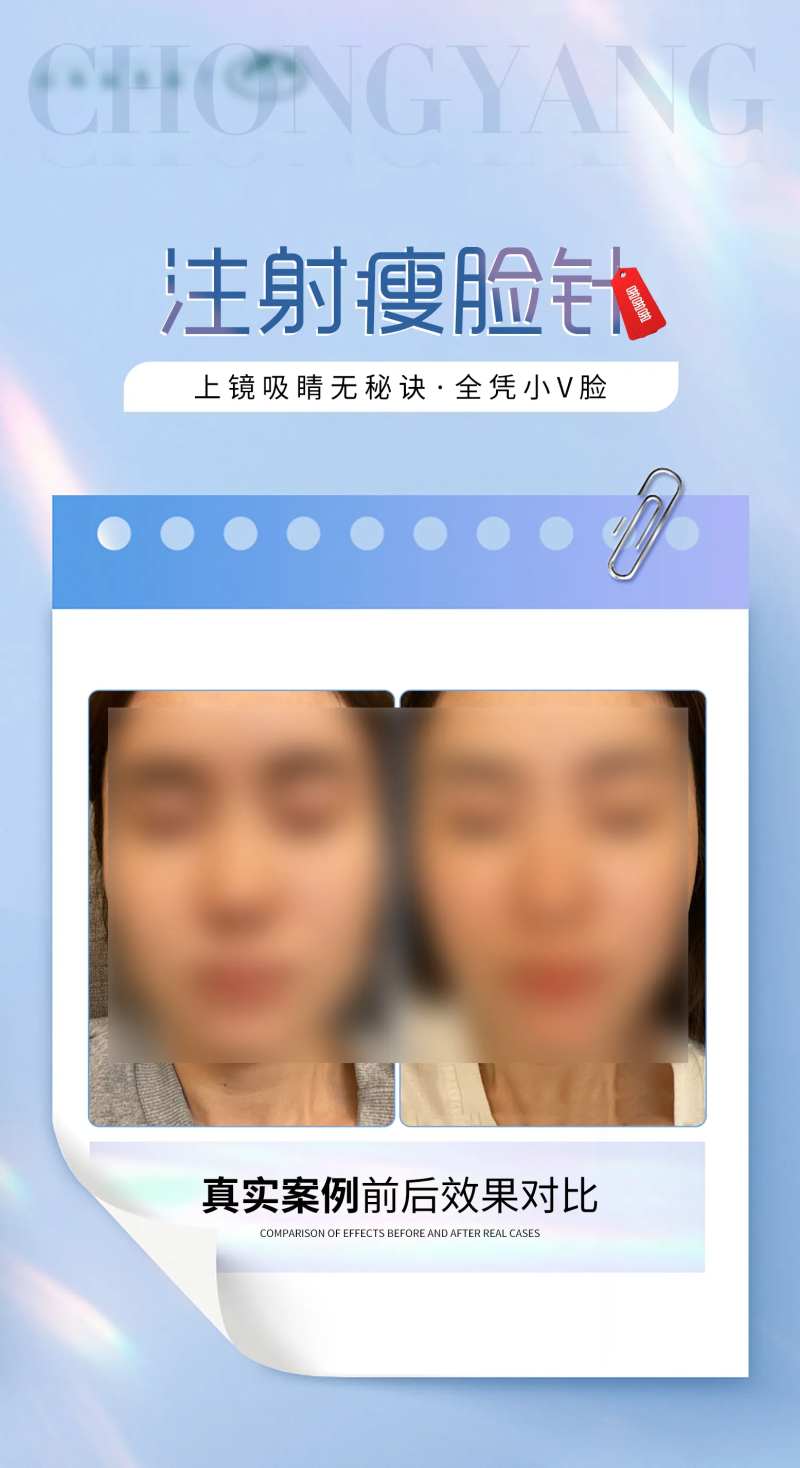 医美瘦脸针案例对比海报-采灵感-cailinggan.com