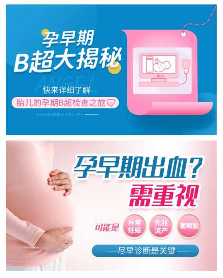孕早期B超海报-采灵感-https://www.cailinggan.com/