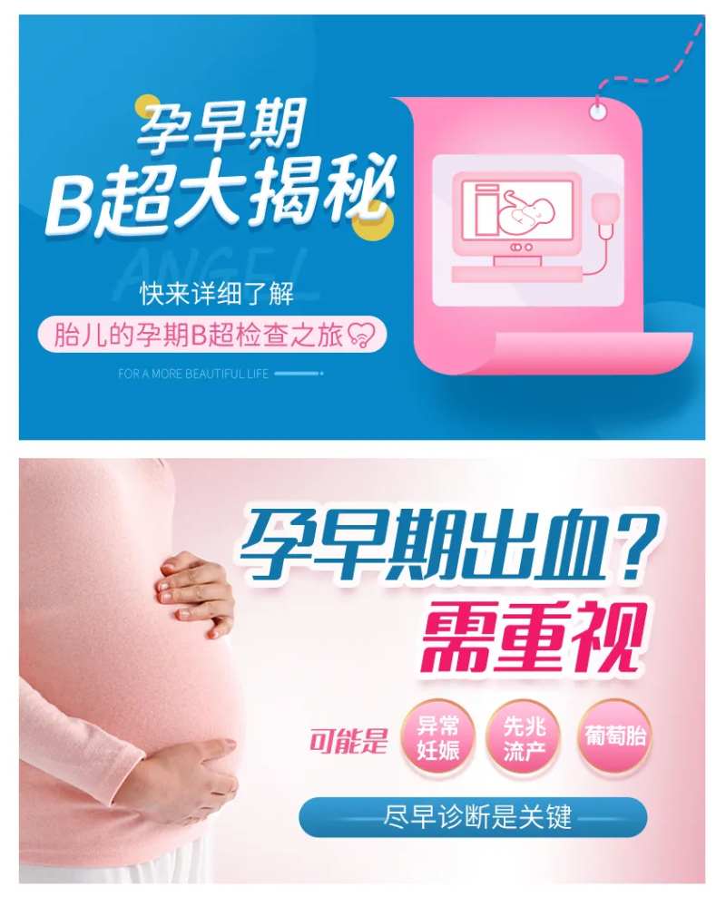 孕早期B超海报-采灵感-cailinggan.com