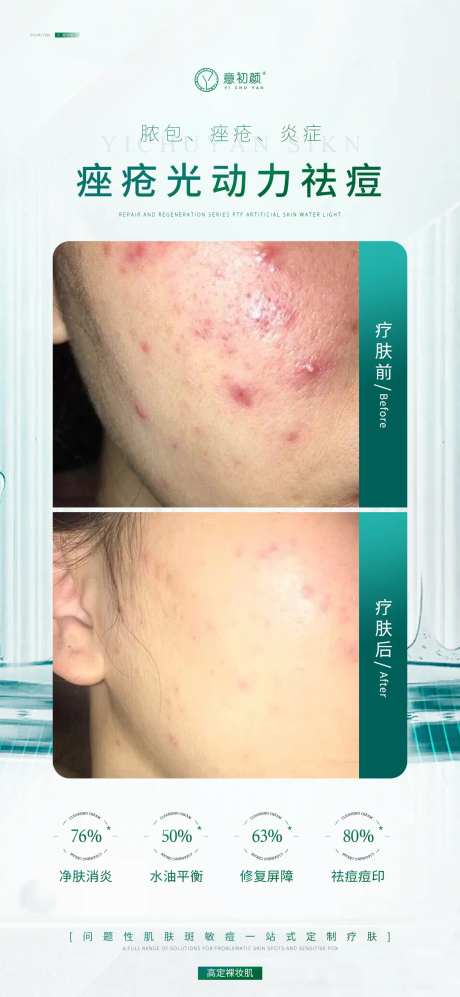 医美美容模特对比简约海报-采灵感-https://www.cailinggan.com/