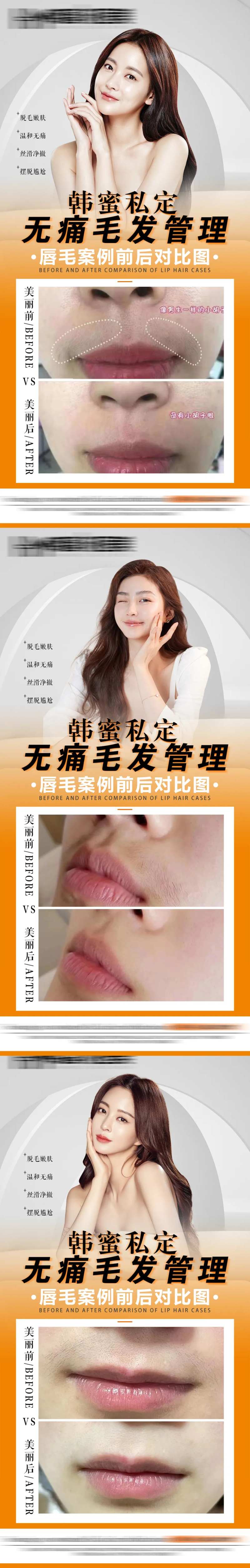 脱毛案例对比图-采灵感-cailinggan.com
