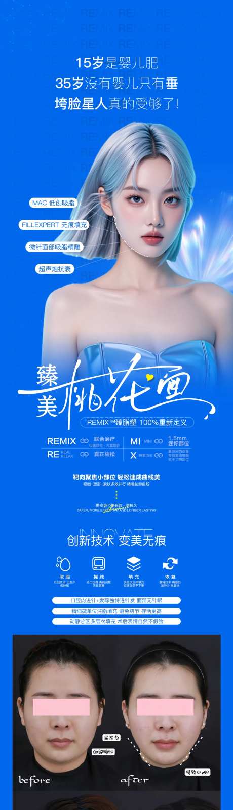 面部吸脂-采灵感-https://www.cailinggan.com/