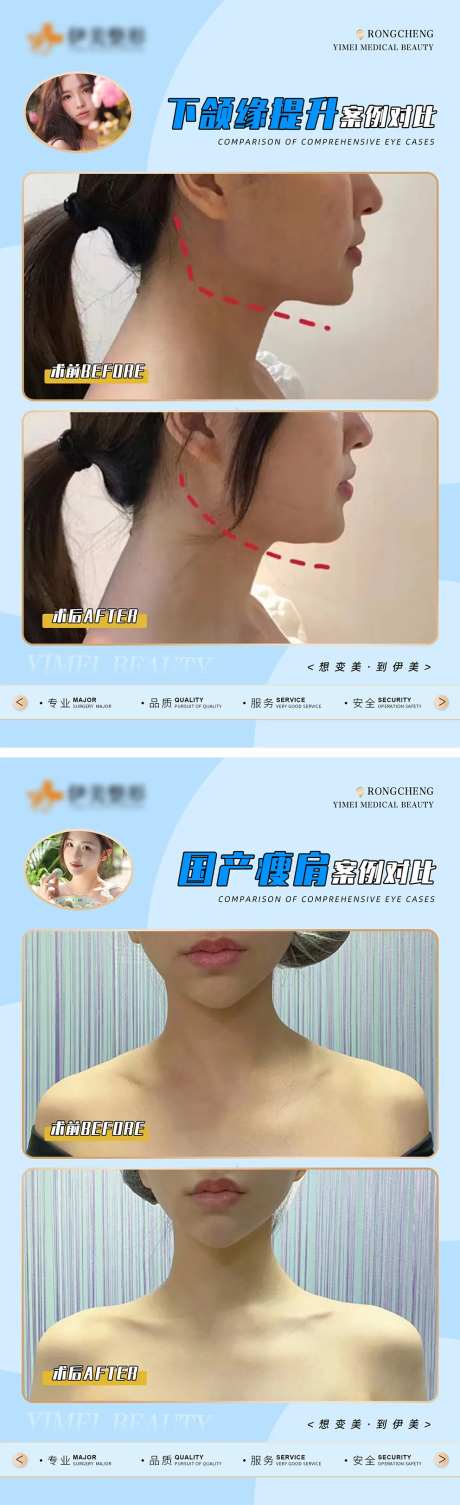 医美案例对比模版-采灵感-https://www.cailinggan.com/