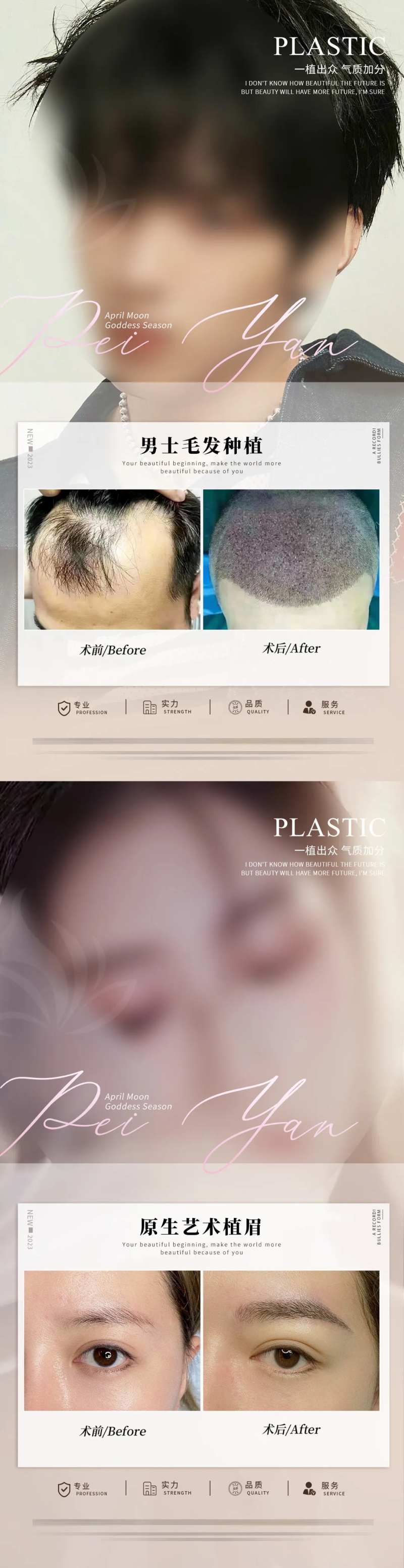 植发案例-采灵感-cailinggan.com