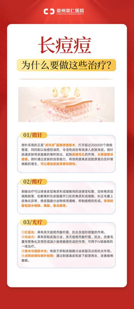 痘痘科普治疗展架-采灵感-https://www.cailinggan.com/