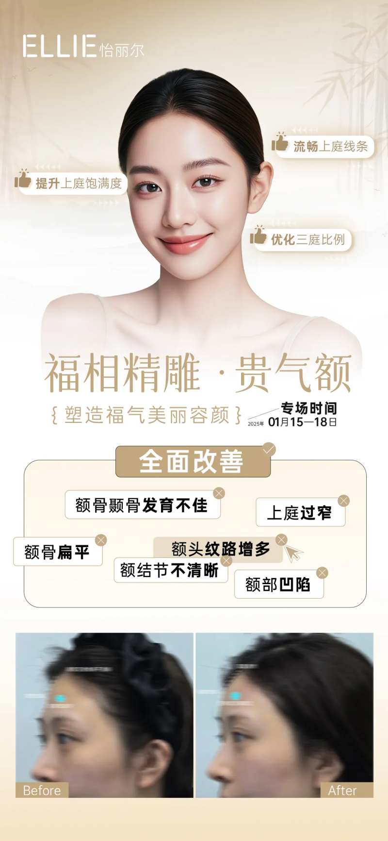 医美东方美学-贵气额海报-采灵感-cailinggan.com