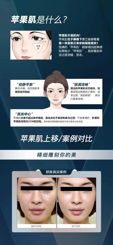 苹果肌提升案例对比海报-采灵感-https://www.cailinggan.com/