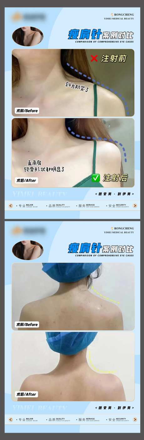 医美案例模板-采灵感-https://www.cailinggan.com/