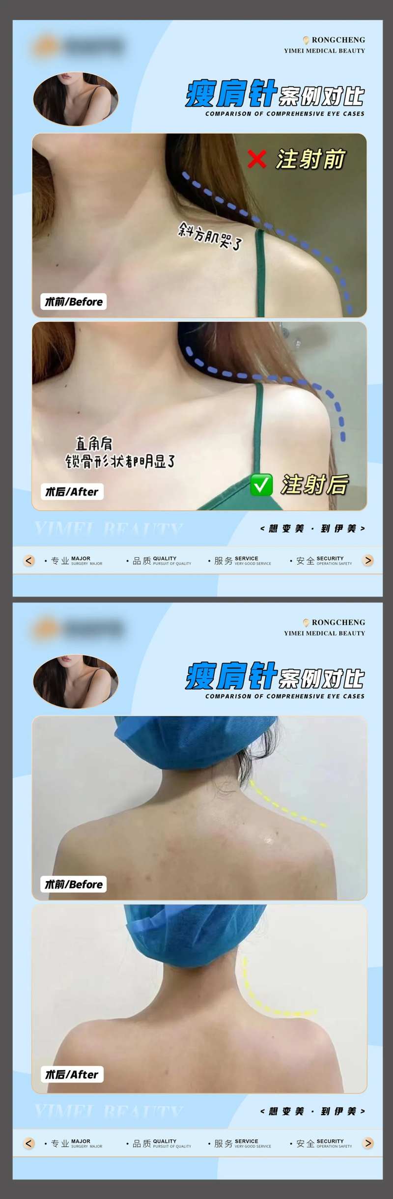 医美案例模板-采灵感-cailinggan.com