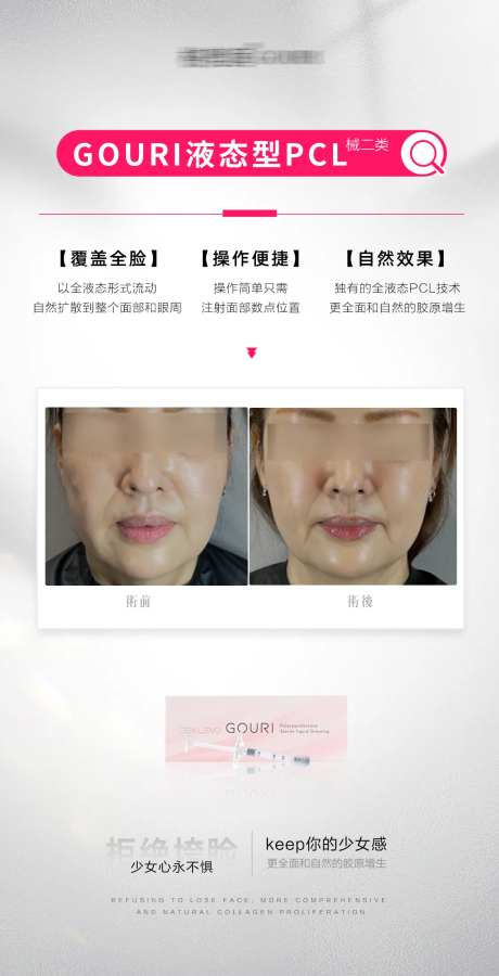 胶原蛋白胶原刺激再生pcl刺激-采灵感-cailinggan.com