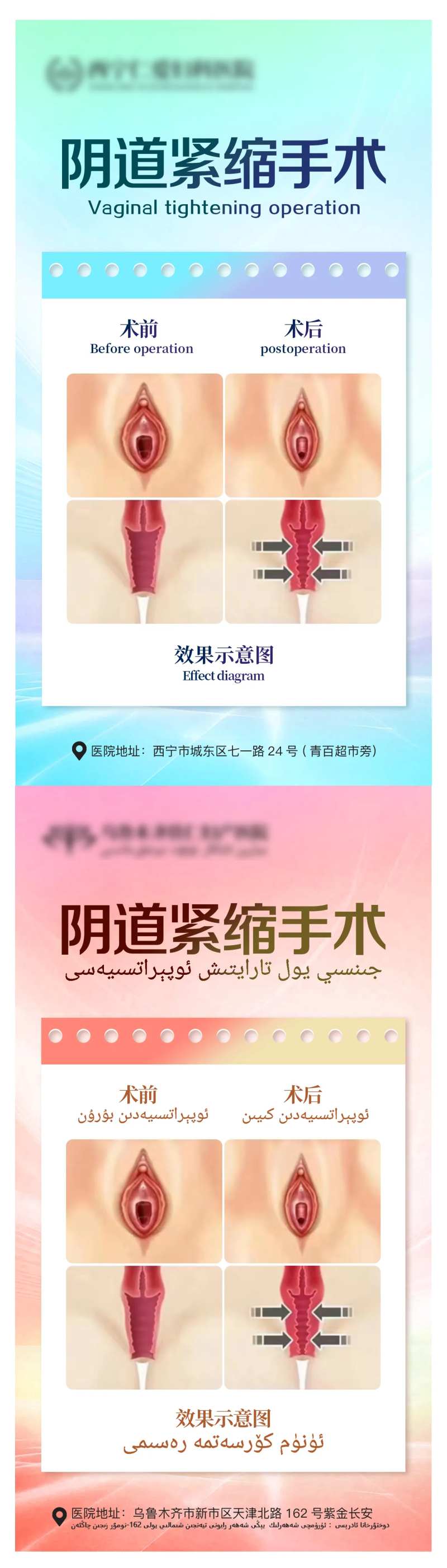 阴道紧缩手术海报-采灵感-cailinggan.com