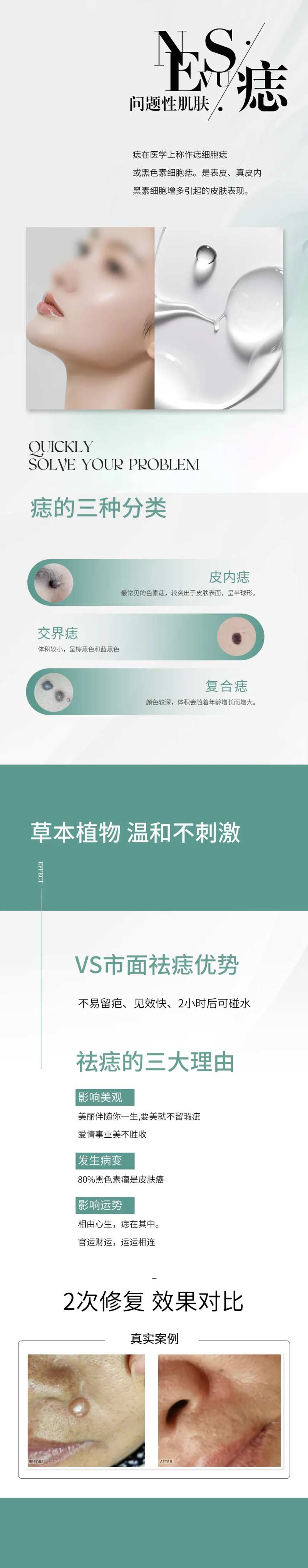 问题性肌肤痣-采灵感-cailinggan.com