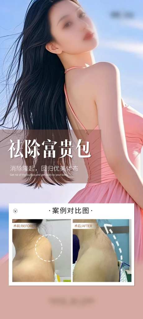 医美祛除富贵包案例海报-采灵感-https://www.cailinggan.com/