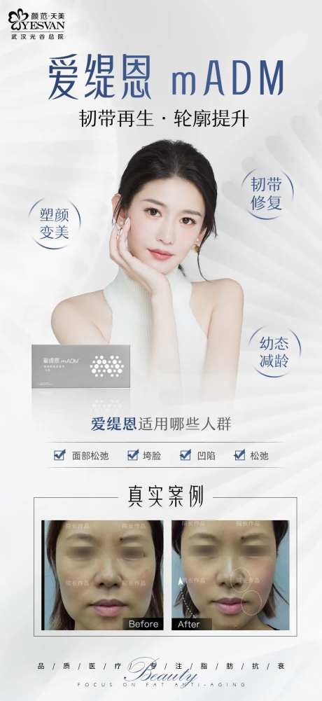 爱缇恩项目宣传海报-采灵感-https://www.cailinggan.com/