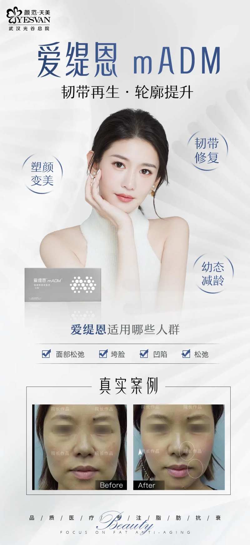 爱缇恩项目宣传海报-采灵感-cailinggan.com