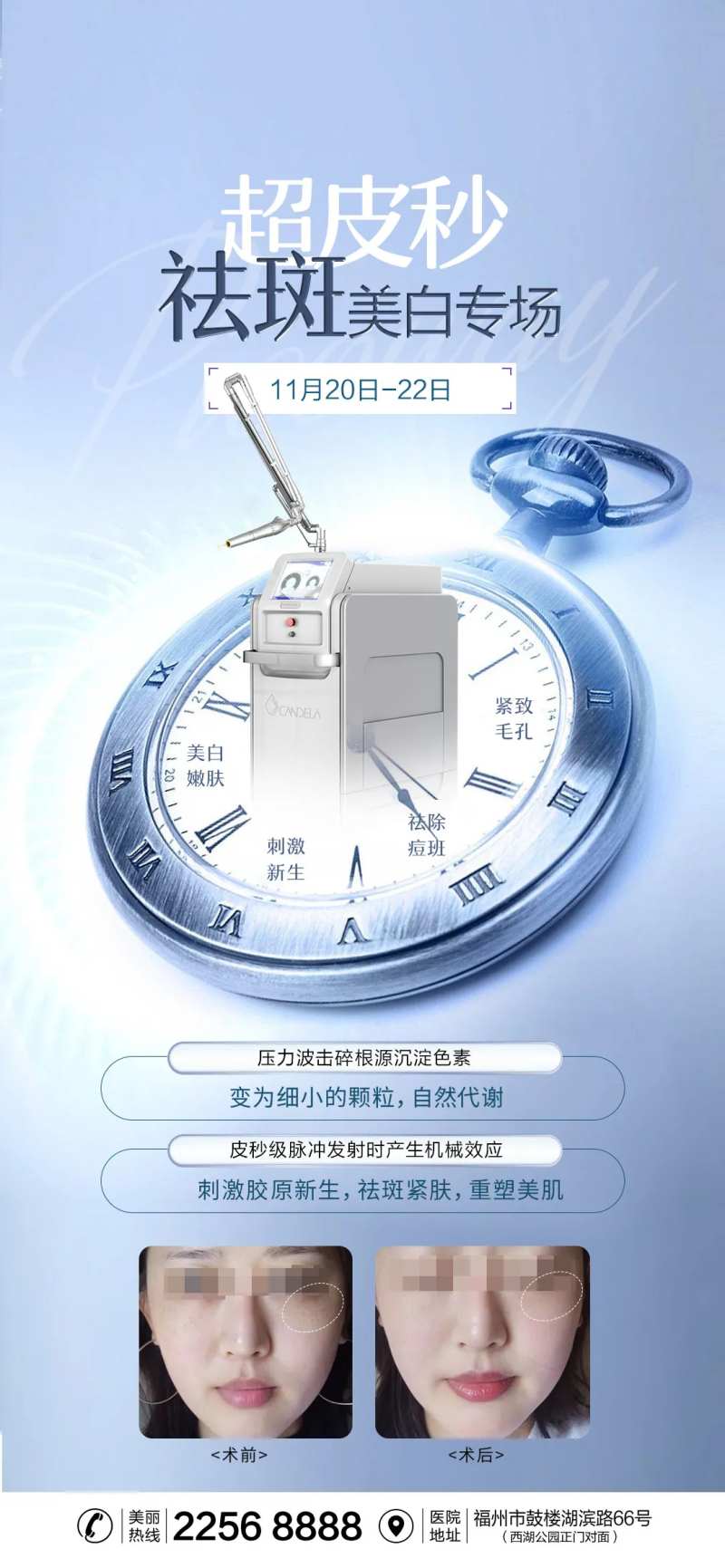 医美超皮秒祛斑海报-采灵感-cailinggan.com