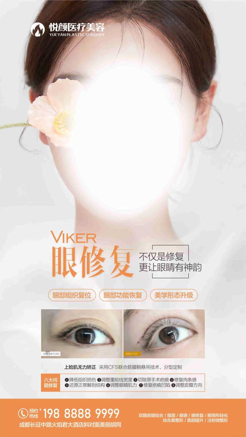 眼修复眼整形海报-采灵感-cailinggan.com