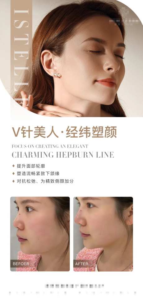 下颌缘提升医美案例对比海报-采灵感-https://www.cailinggan.com/