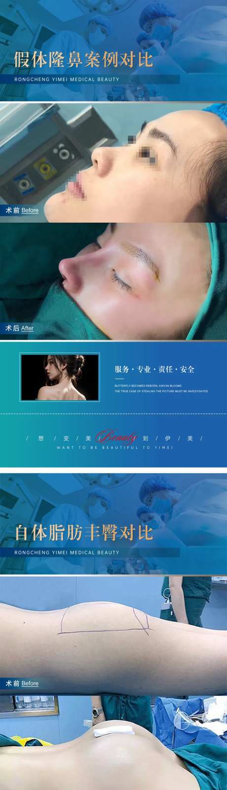 医美整形案例对比模版-采灵感-https://www.cailinggan.com/