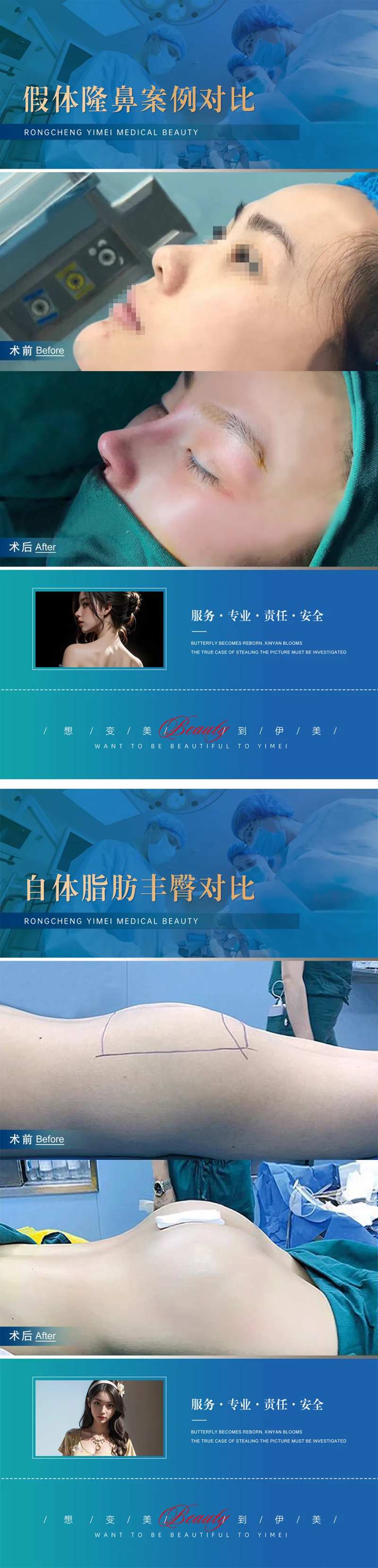 医美整形案例对比模版-采灵感-cailinggan.com
