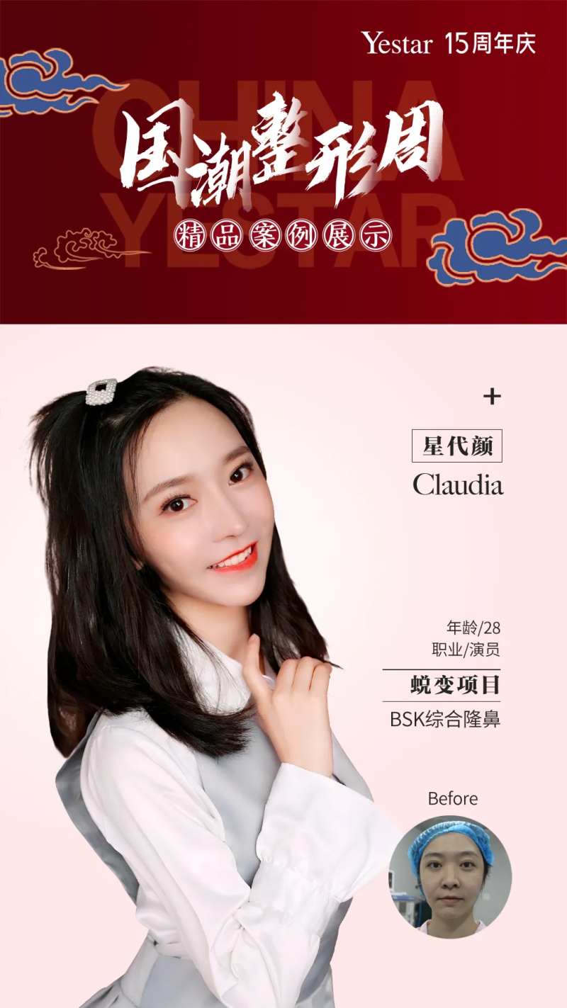 医美真人秀代言海报-采灵感-cailinggan.com