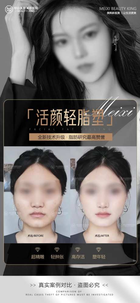 医美脸部填充案例海报-采灵感-https://www.cailinggan.com/