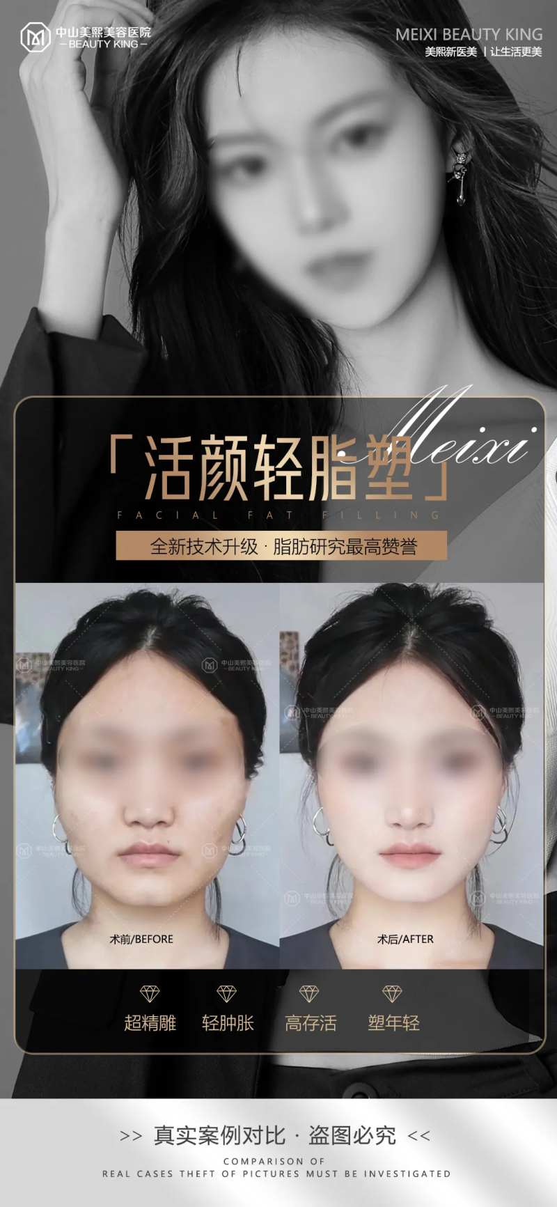 医美脸部填充案例海报-采灵感-cailinggan.com