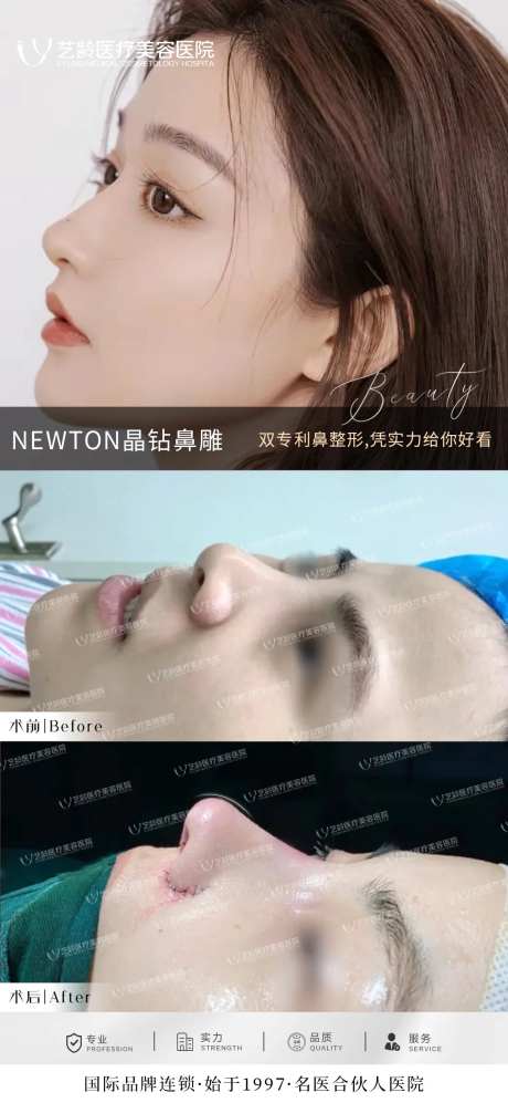 鼻综合案例-采灵感-https://www.cailinggan.com/