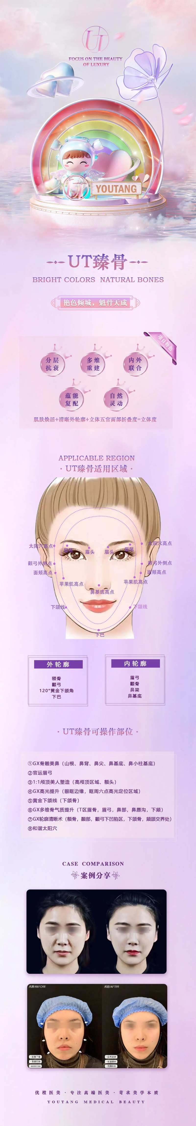 医美轮廓固定详情页-采灵感-cailinggan.com