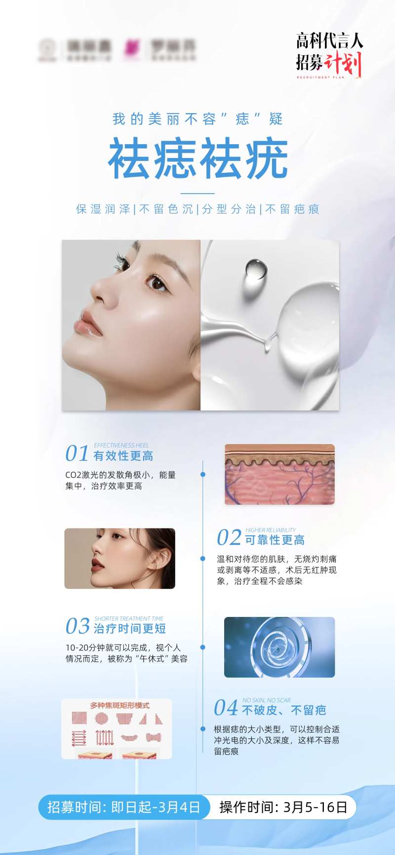 祛痣祛疣-采灵感-cailinggan.com