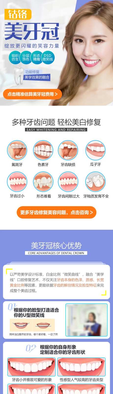 钴铬美牙冠专题-采灵感-https://www.cailinggan.com/