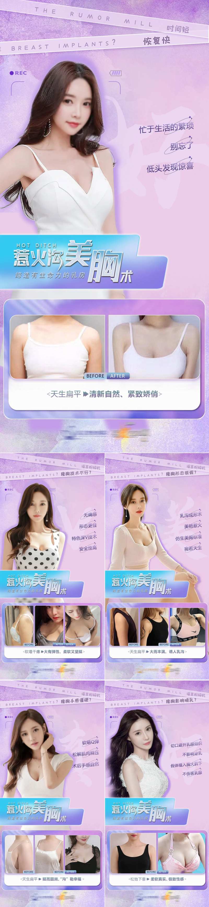 医美美胸术案例海报-采灵感-cailinggan.com